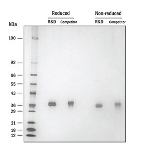 SARS-CoV-2 Spike RBD Protein