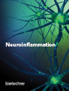 Neuroinflammation