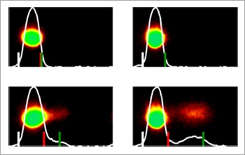 CometAssay Single Cell Gel Electrophoresis Software