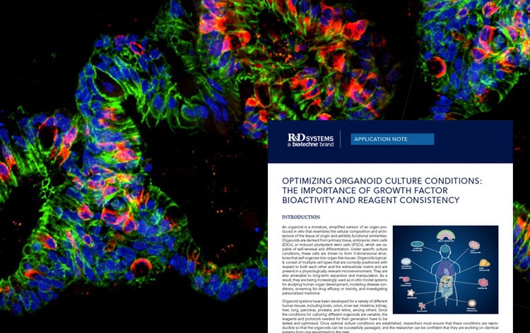 Optimizing Organoid Culture Conditions