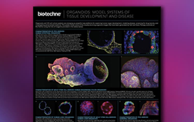 Snapshot of the new organoids wall poster