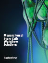 Mesenchymal Stem Cells