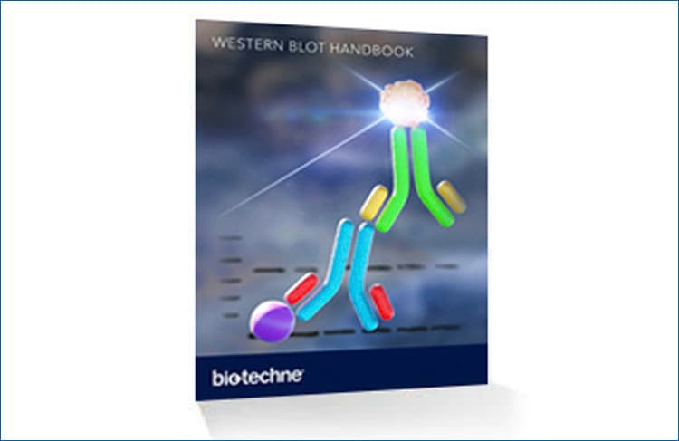 western blot handbook