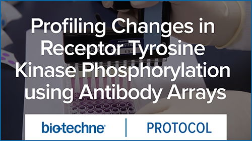 Profiling Changes in Receptor Tyrosine Kinase Phosphorylation using Antibody Arrays